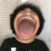 Đồn
