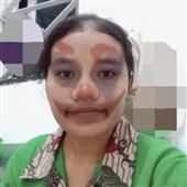 Fru