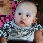 Bản